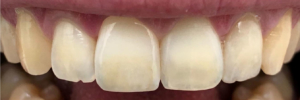denti centrali panoramica