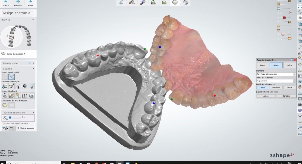 Il passaggio dalla “Funzione” Analogica a quella Digitale richiederà ancora del tempo, visto che la digitalizzazione di primo livello (scanner intraorali) negli studi dentistici è ancora in atto.