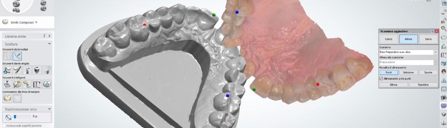 Il passaggio dalla “Funzione” Analogica a quella Digitale richiederà ancora del tempo, visto che la digitalizzazione di primo livello (scanner intraorali) negli studi dentistici è ancora in atto.