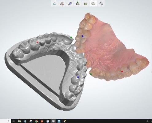 Il passaggio dalla “Funzione” Analogica a quella Digitale richiederà ancora del tempo, visto che la digitalizzazione di primo livello (scanner intraorali) negli studi dentistici è ancora in atto.